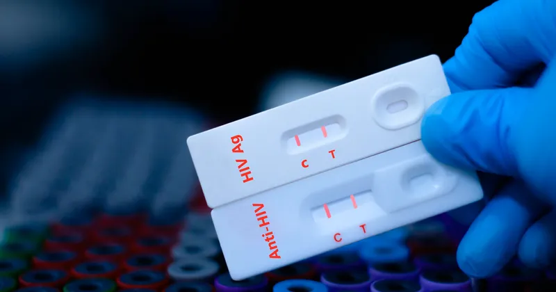 Rekordowa ilość zakażeń wirusem HIV w Polsce. Posłowie pytają o leczenie